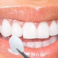 Zirconium Veneers - Dental Clinic in Bodrum - Myndosdent